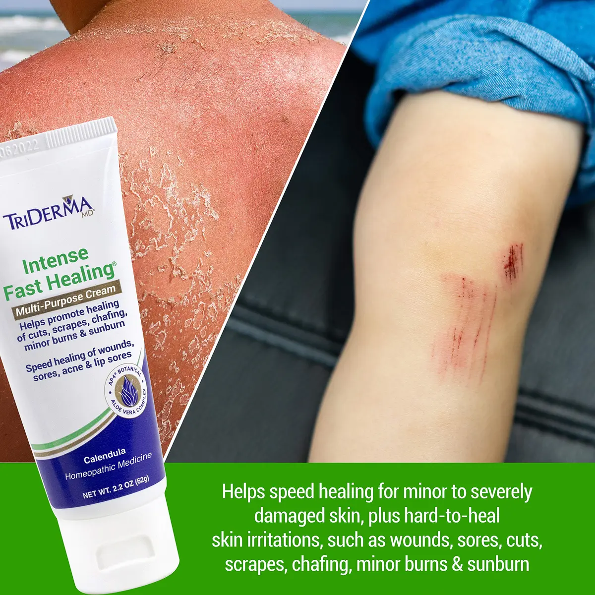 TriDerma Intense Fast Skin Healing Cream 2.2 oz | All-Purpose Skin Repair for Sensitive Skin - view 3