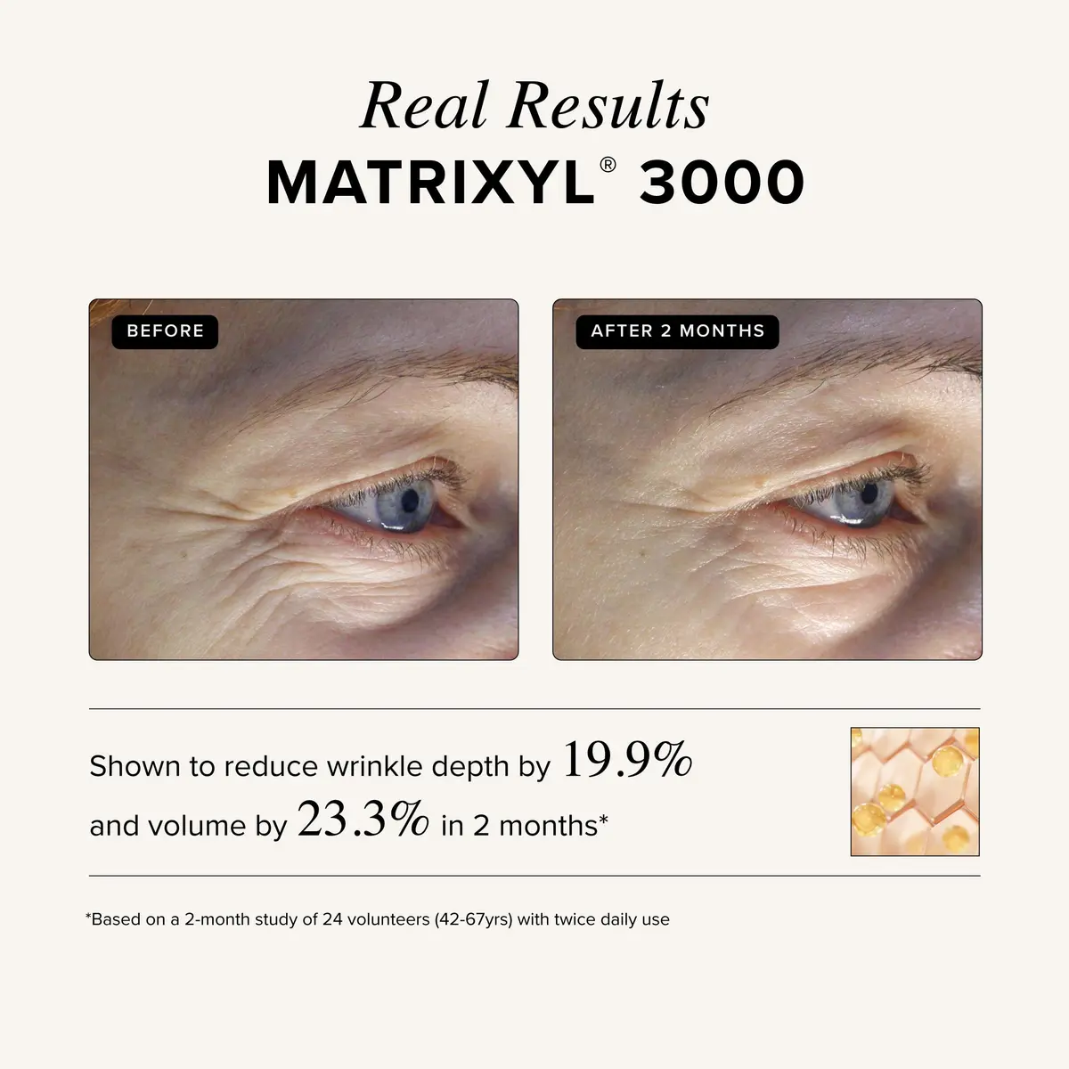 Asterwood Matrixyl 3000 & Argireline Peptide Serum with Hyaluronic Acid | Anti-Aging, 8 Fl Oz - view 5