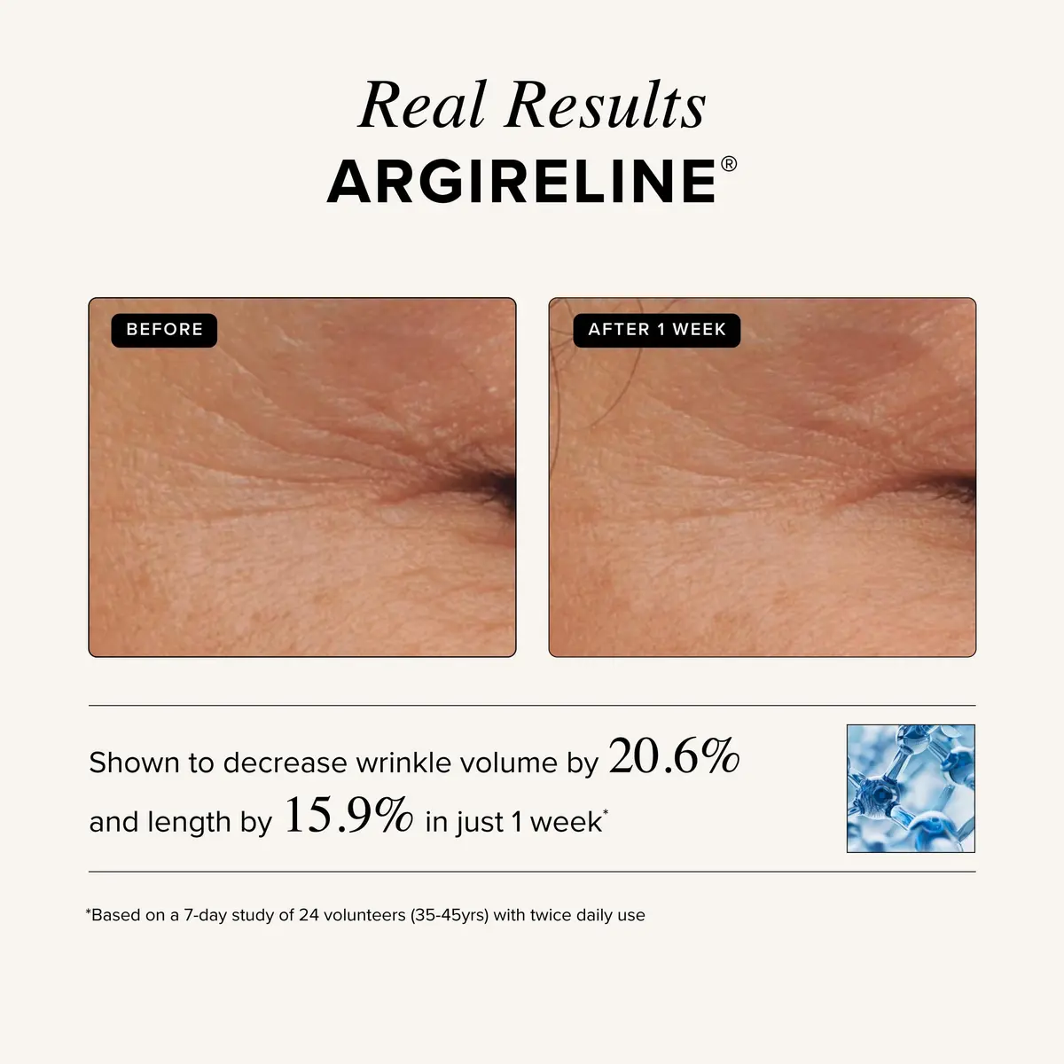 Asterwood Matrixyl 3000 & Argireline Peptide Serum with Hyaluronic Acid | Anti-Aging, 8 Fl Oz - view 4