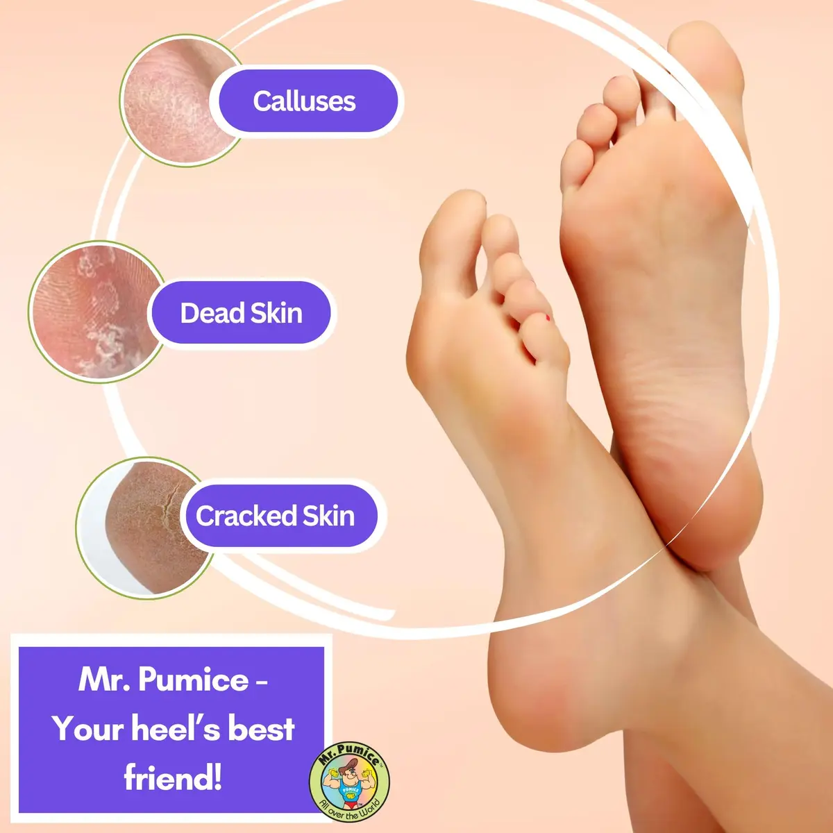 Mr. Pumice Ultimate PUMI Bar 2-in-1 Dual Grit (Medium + Coarse) Callus Remover for Feet & Heels | 4 Pack - view 5