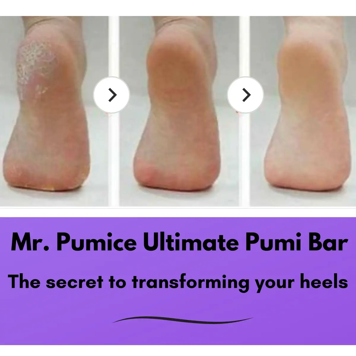 Mr. Pumice Ultimate PUMI Bar 2-in-1 Dual Grit (Medium + Coarse) Callus Remover for Feet & Heels | 4 Pack - view 3