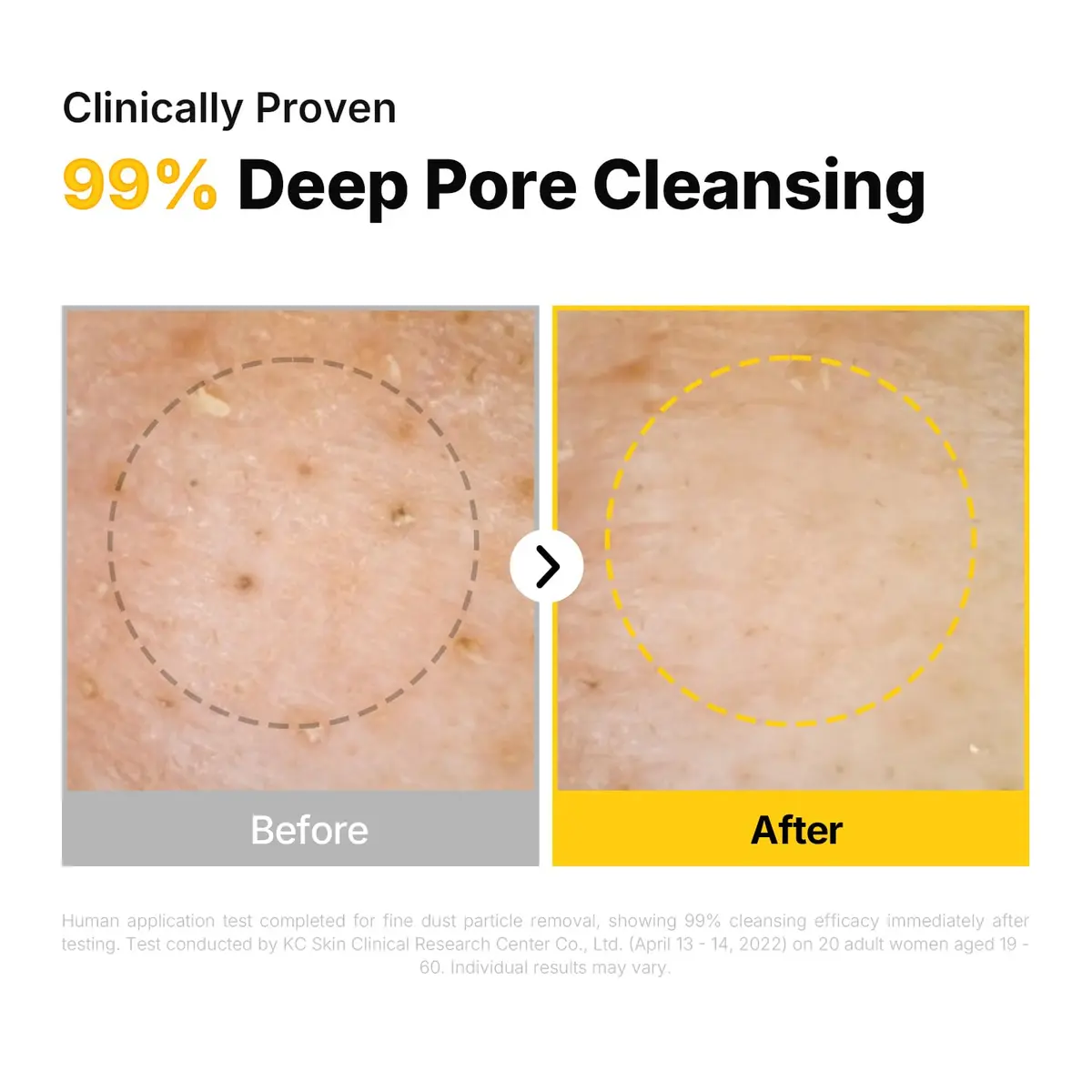 MANYO Pure Cleansing Oil 200ml (6.76 fl oz) | Deep Pore Cleanser for All Skin Types - view 5