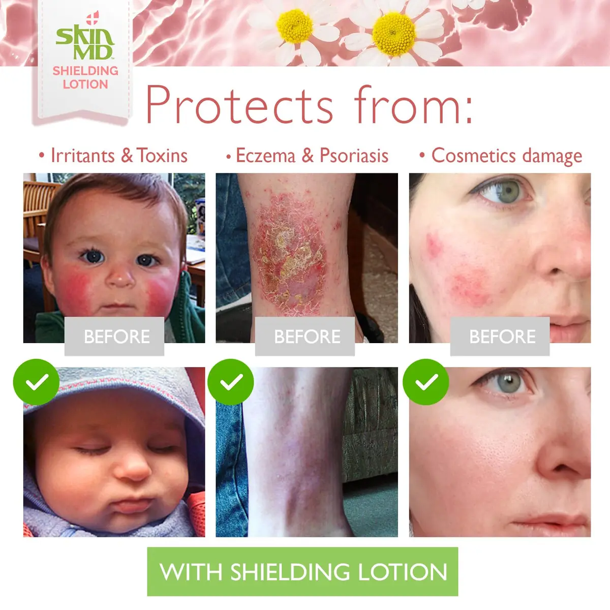 Skin MD Shielding Lotion Hydrating Body Lotion for Sensitive Skin with Dispenser | Non-Greasy, Fast-Absorbing Moisturizer with Plant-Based Ingredients, Eczema & Psoriasis Relief - 8oz 2-Pack - view 5