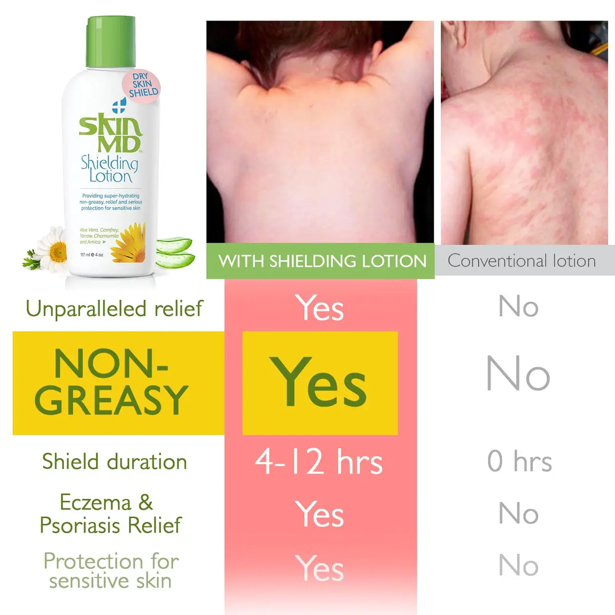 Skin MD Shielding Lotion Hydrating Body Lotion for Sensitive Skin with Dispenser | Non-Greasy, Fast-Absorbing Moisturizer with Plant-Based Ingredients, Eczema & Psoriasis Relief - 8oz 2-Pack - view 2