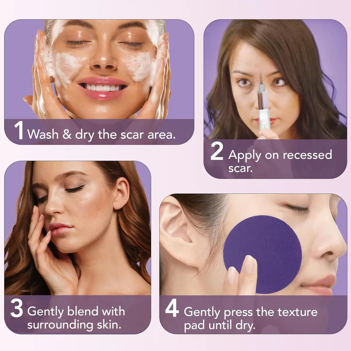 Dermaflage Scar Filler Kit - Deep - Waterproof Concealer for Acne & Wrinkles, 1 mo supply - view 4