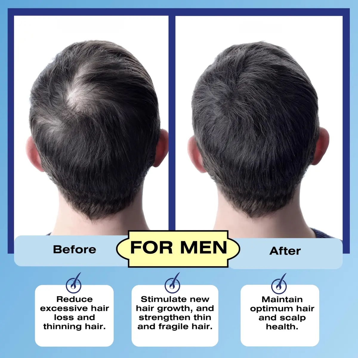 Mediceuticals Follicle Revitalizer 4.23 oz (150 ml) | DHT Blocker for Men & Women, Hair Follicle & Scalp Stimulator - view 5