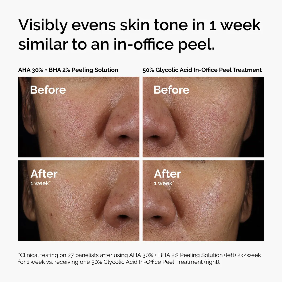 The Ordinary AHA 30% + BHA 2% Peeling Solution for Brighter Skin, 30ml - view 6