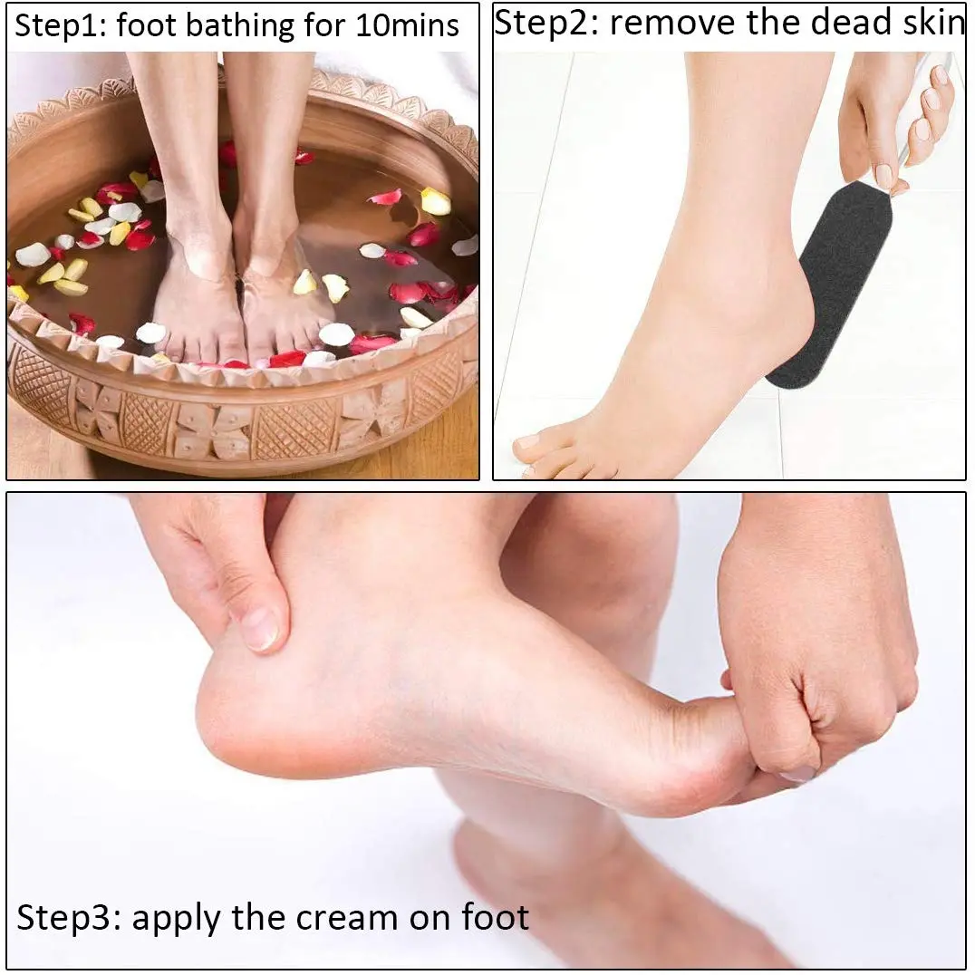 Homeve Pedicure Foot File Reusable Stainless Steel Cracked Skin Callus Remover Feet Rasp | Ergonomic & Durable - view 6