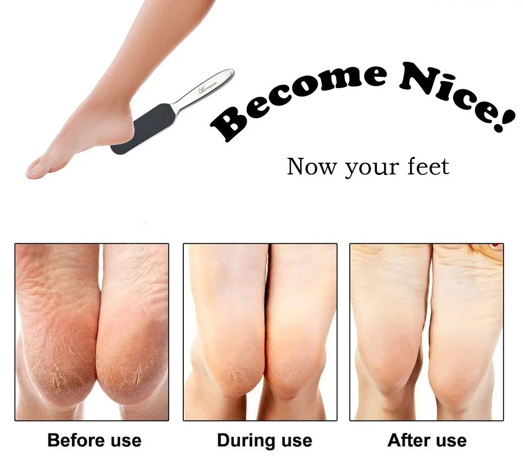 Homeve Pedicure Foot File Reusable Stainless Steel Cracked Skin Callus Remover Feet Rasp | Ergonomic & Durable - view 7