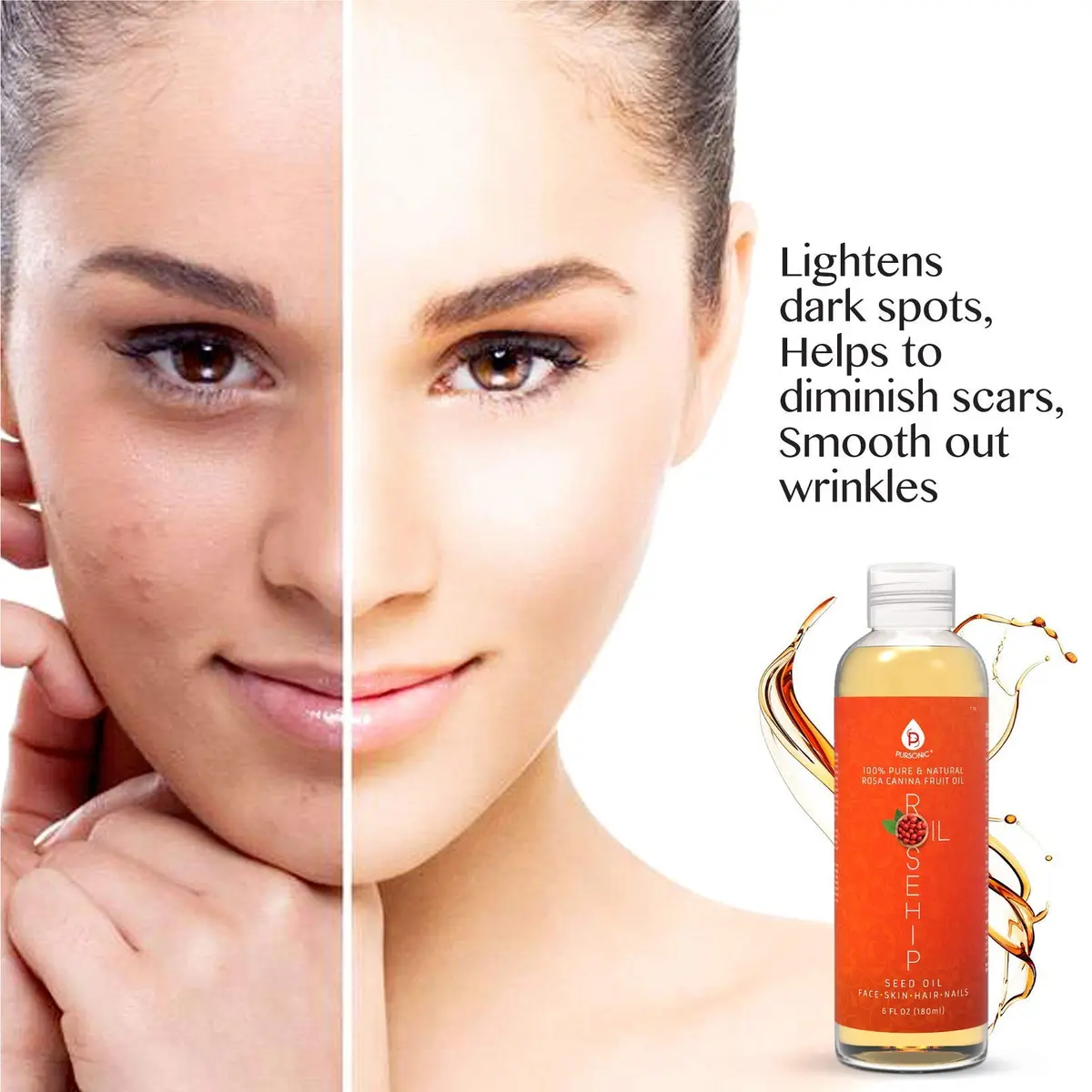 Pursonic Rosehip Seed Oil 6 Fl Oz | Hydrating & Brightening for Dry, Sensitive Skin - view 5