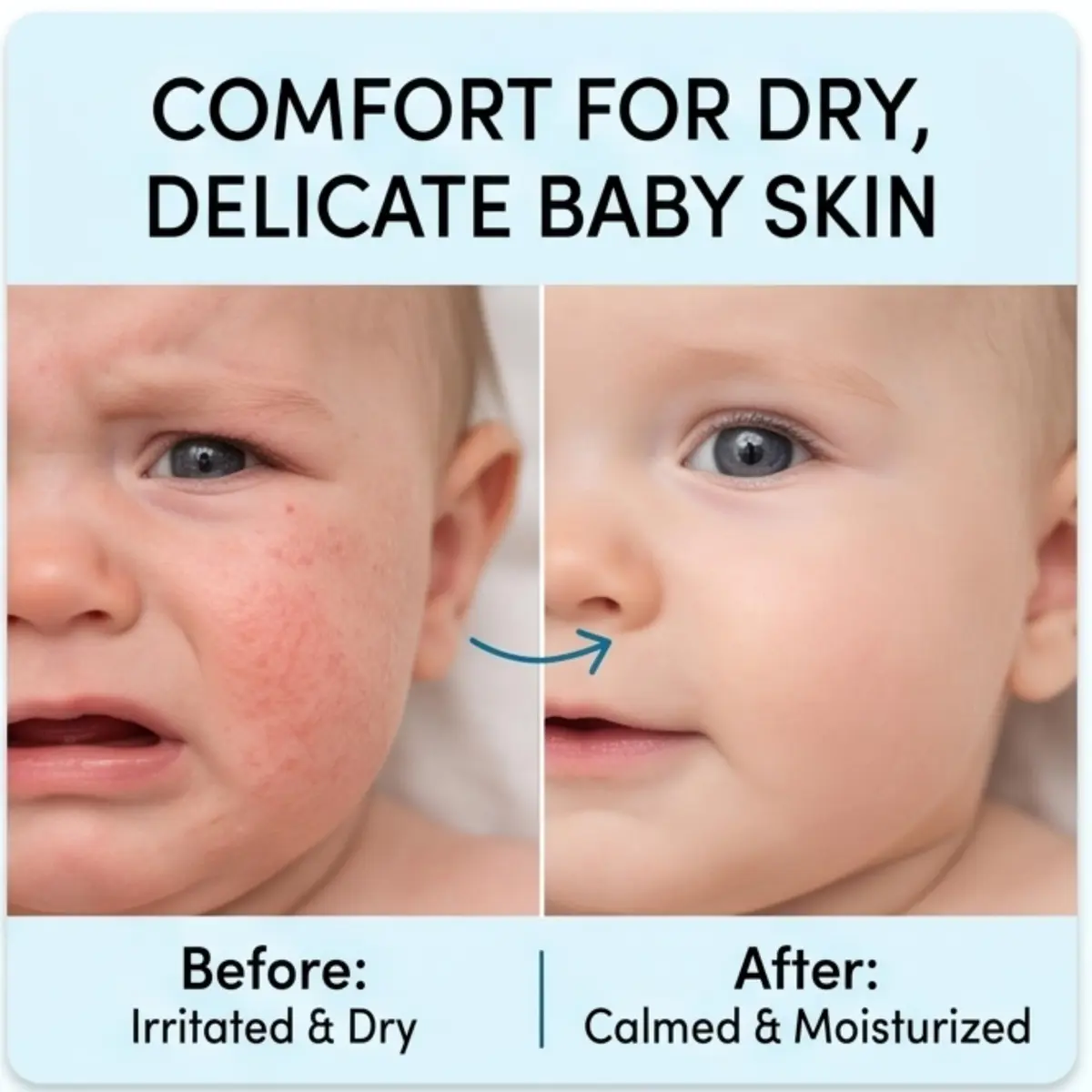 Green Goo Baby Balm, Organic Gentle Moisturizing & Soothing Baby Lotion, 4 Oz Jar | Supports Sensitive Skin & Skin Irritations - view 4