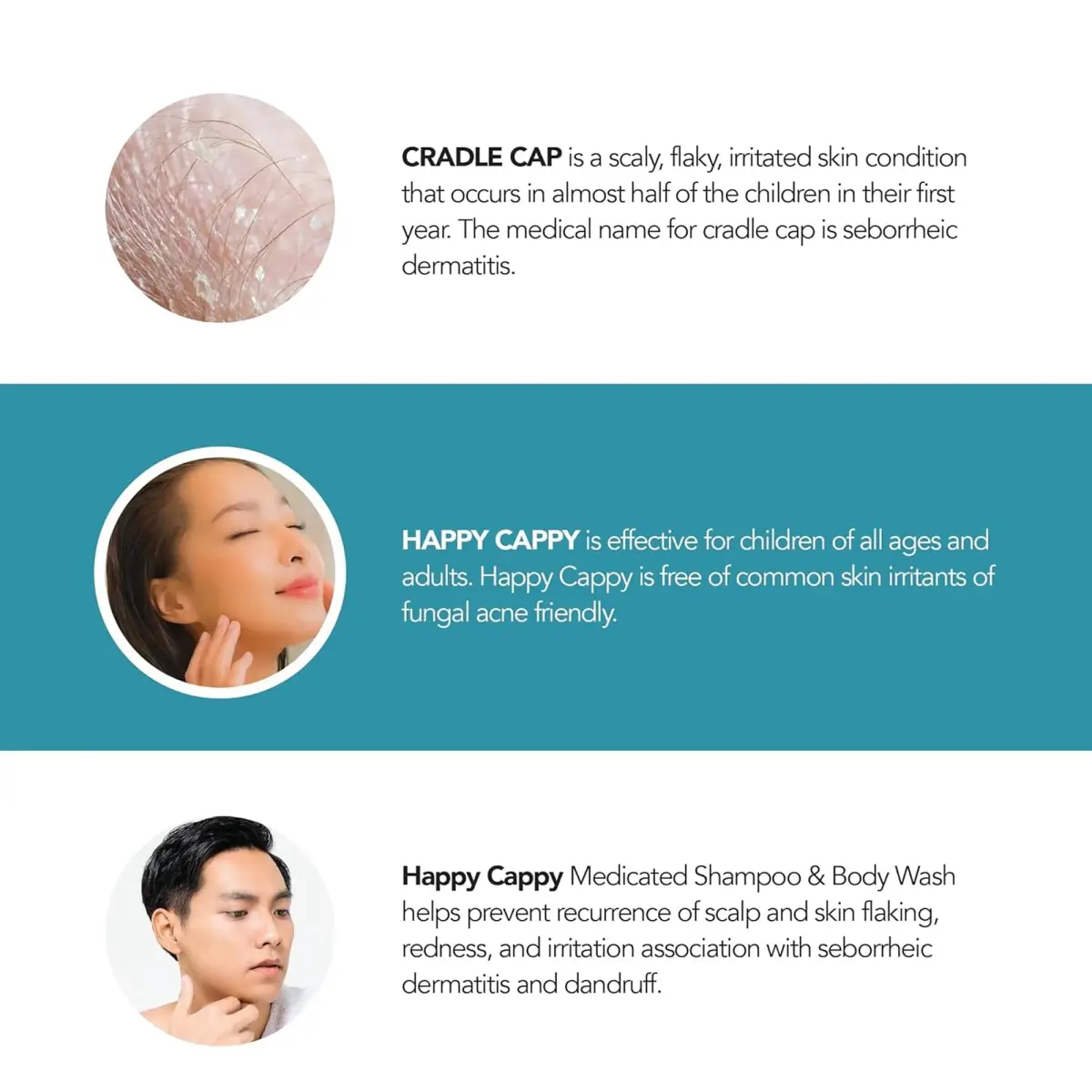Happy Cappy Medicated Baby Shampoo and Body Wash 237ml (8 Fl Oz) | Pediatrician-Formulated for Dandruff & Cradle Cap - view 4