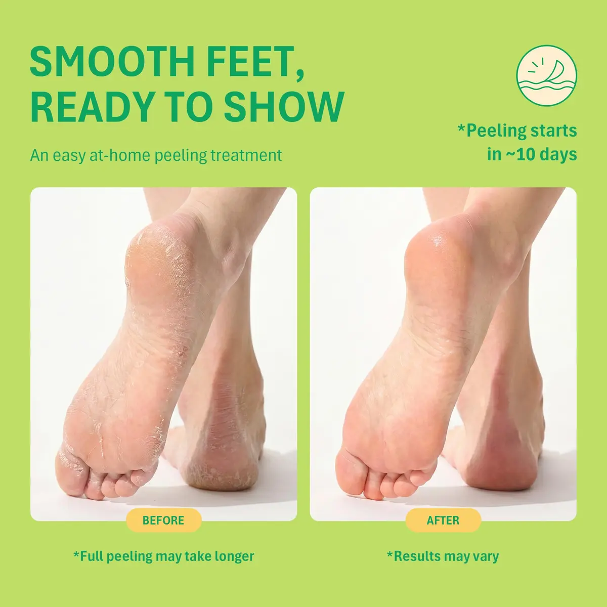 Purederm Foot Peeling Mask for Dry Cracked Feet | Exfoliating & Nourishing Treatment, 6 Pairs - view 3