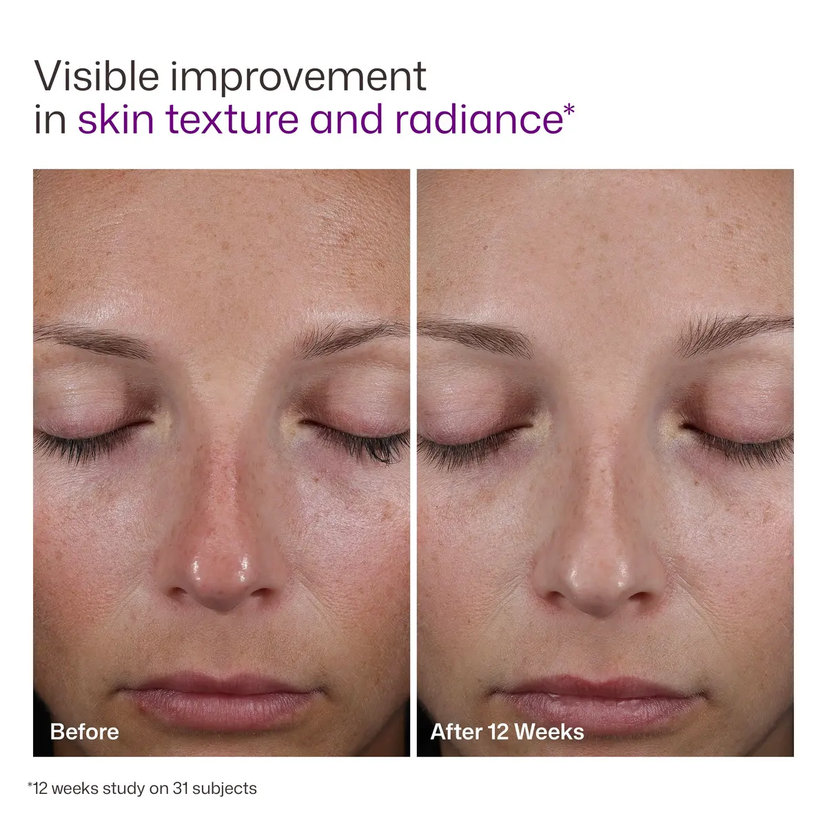 EltaMD UV AOX Elements 100% Mineral Tinted Face Sunscreen SPF 50 | Hydrates & Protects Sensitive Skin - view 9