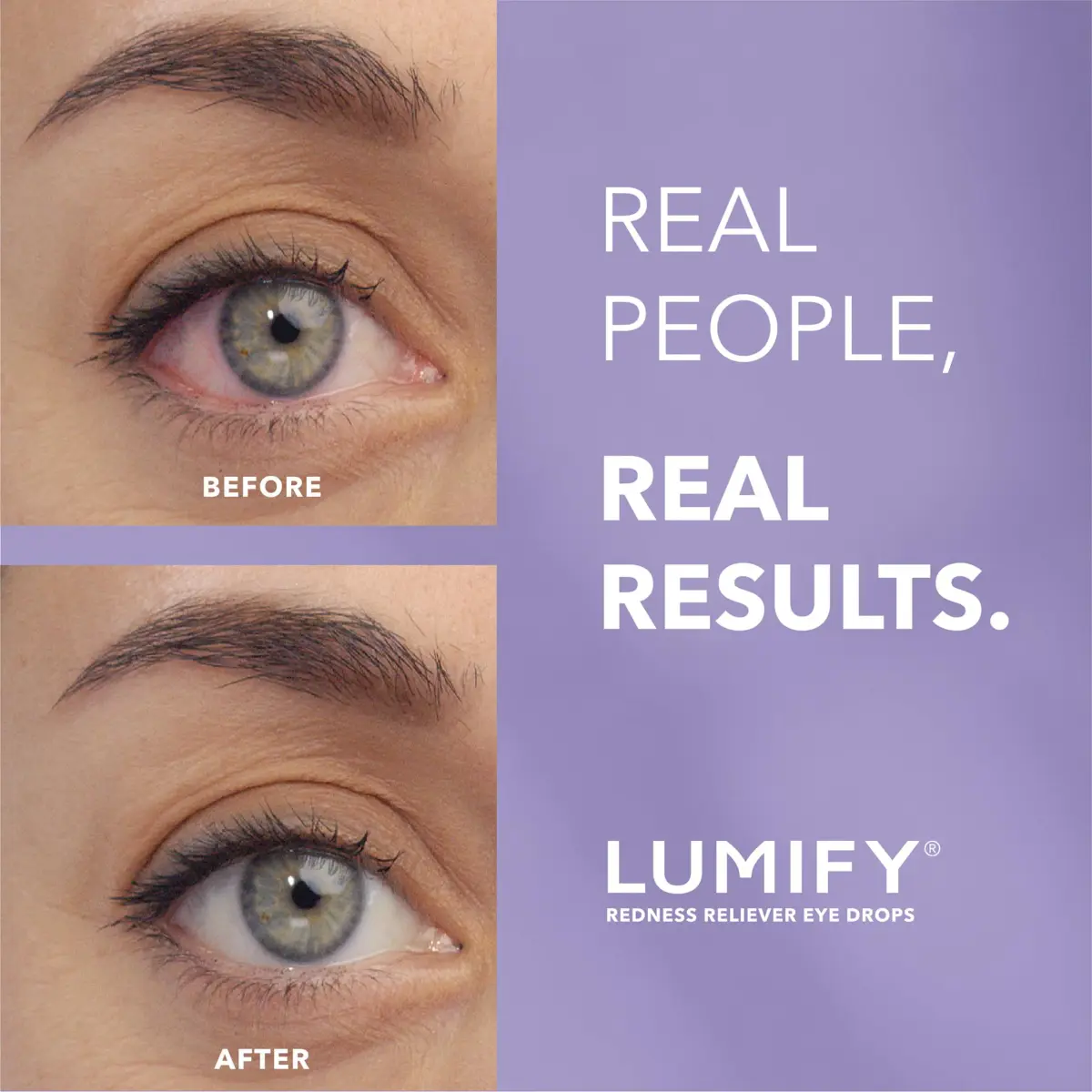 LUMIFY Redness Relief Eye Drops 7.5ml (0.25 Fl Oz) | FDA Approved for Whiter, Brighter Eyes - view 2