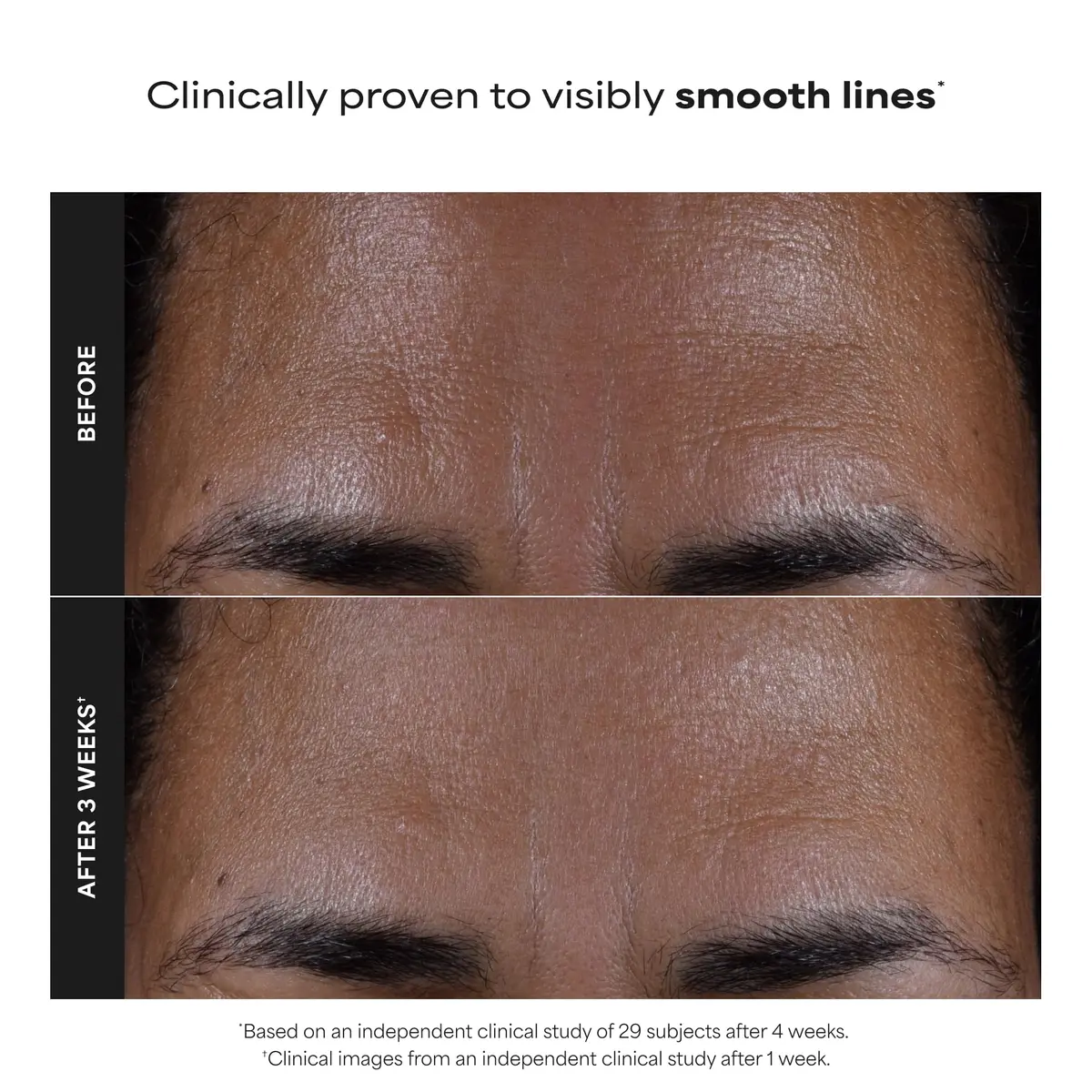 Paula's Choice SKIN PERFECTING 2% BHA Liquid Exfoliant 150ml (5 Fl Oz) | Gentle Non-Abrasive Leave-On Exfoliant for Pores & Blackheads - view 3