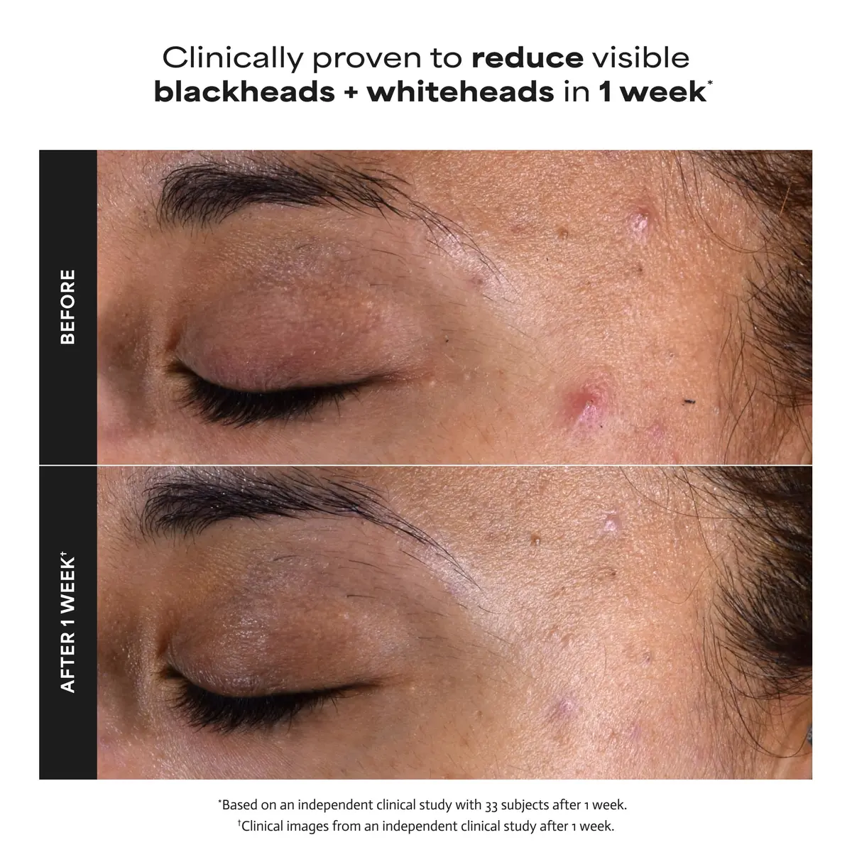 Paula's Choice SKIN PERFECTING 2% BHA Liquid Exfoliant 150ml (5 Fl Oz) | Gentle Non-Abrasive Leave-On Exfoliant for Pores & Blackheads - view 4