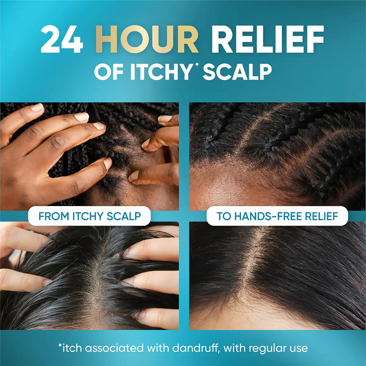 Head & Shoulders Royal Oils Instant Soothe Scalp Elixir 4.2 fl oz | No-Rinse Relief for Textured Hair - view 4