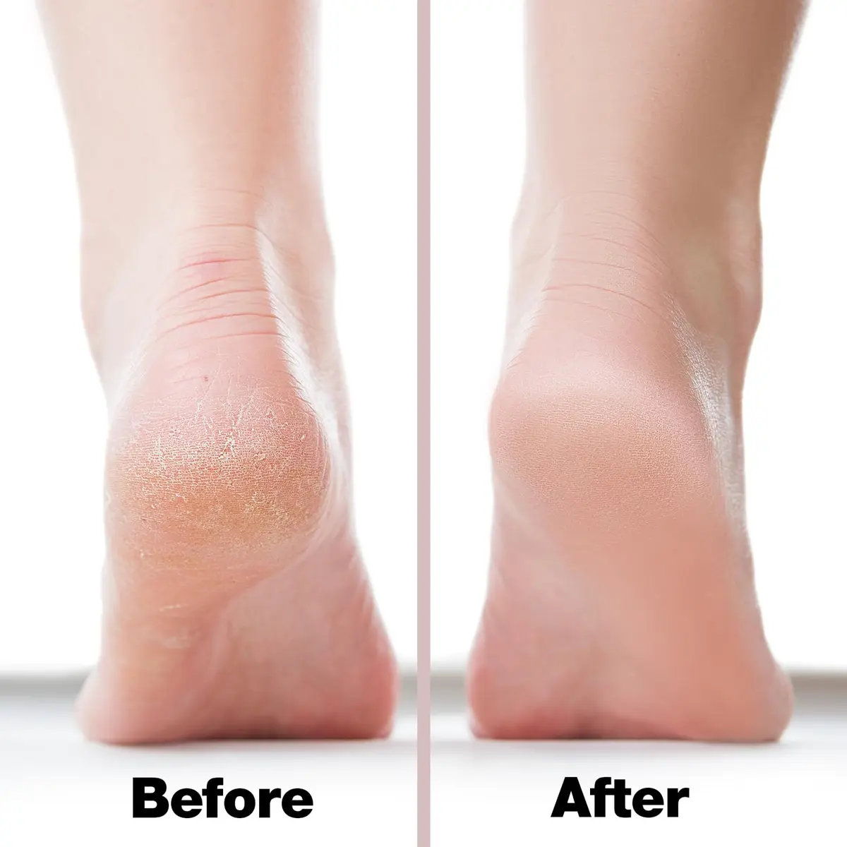 Probelle Double Sided Nickel Foot File Callus Remover, Pink | Safe, Hypoallergenic Pedicure Tool for Soft Feet - view 4