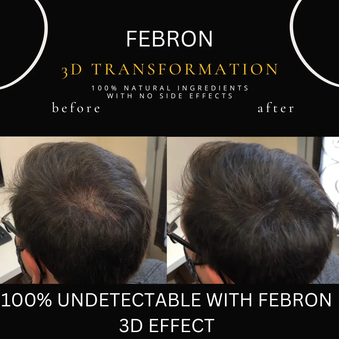 FEBRON Hair Fibers For Thinning Hair Medium Brown 30g | Natural, Undetectable & Lasts All Day - view 6