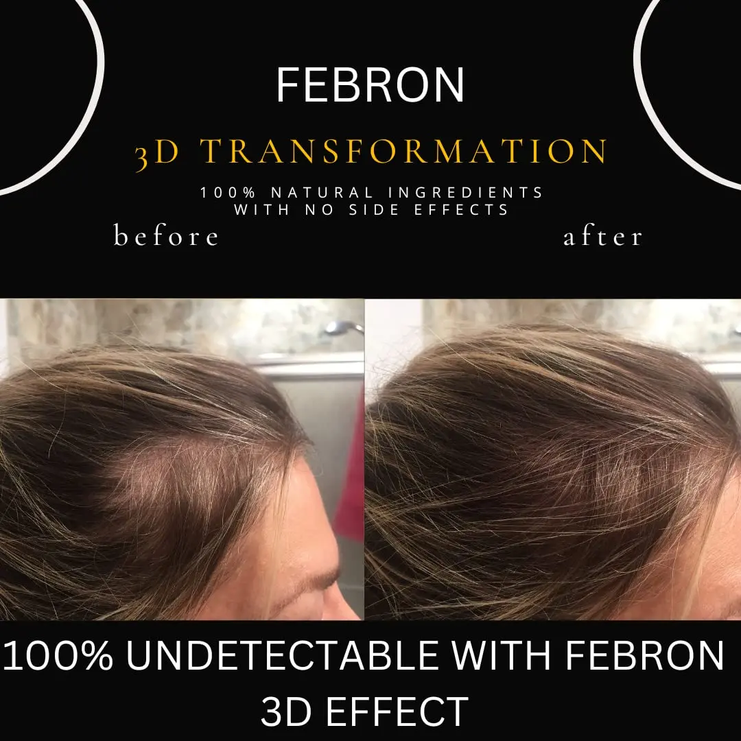 FEBRON Hair Fibers For Thinning Hair Medium Brown 30g | Natural, Undetectable & Lasts All Day - view 5
