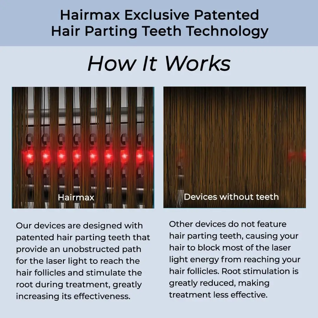 Hairmax Ultima 9 Classic LaserComb | FDA Cleared Red Light for Hair Regrowth in India - view 5