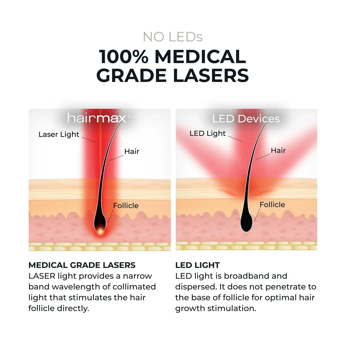 Hairmax Ultima 9 Classic LaserComb | FDA Cleared Red Light for Hair Regrowth in India - view 6