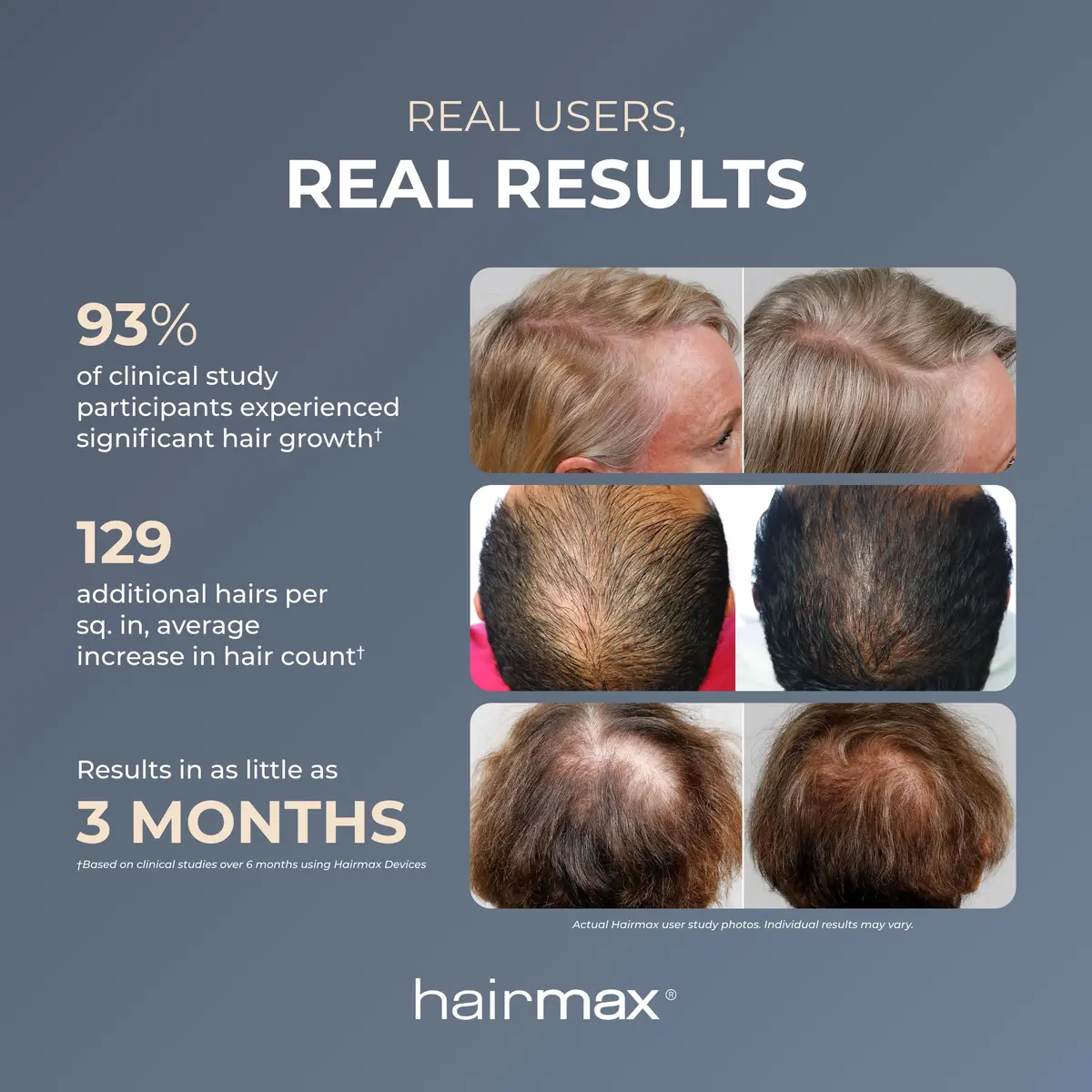 Hairmax Ultima 9 Classic LaserComb | FDA Cleared Red Light for Hair Regrowth in India - view 3