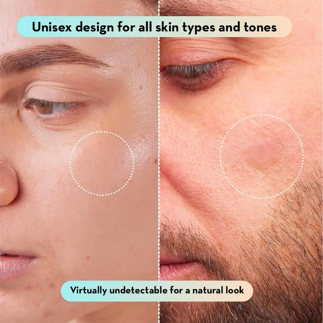 LE GUSHE Korean Pimple Patches with Tea Tree Oil | Hydrocolloid Acne & Zit Patches | 132 Dots | Dermatologist Tested - view 8