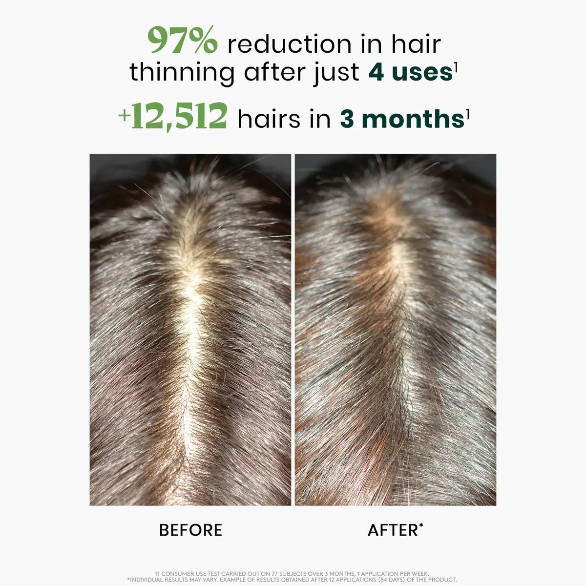René Furterer Triphasic Reactional Hair Thickening Serum, 1.92 Fl Oz | Supports Hair Vitality & Thinning - view 3