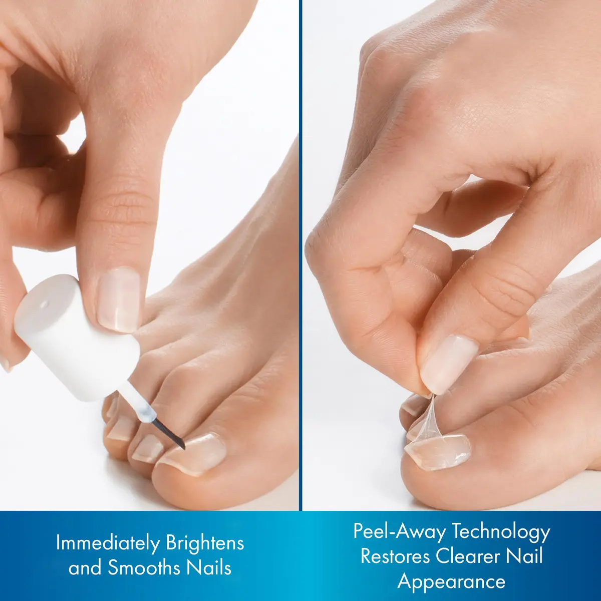 ProClearz Brite Now Nail Treatment 0.5 Fl Oz | Brightening & Smoothing Nail Repair - view 3
