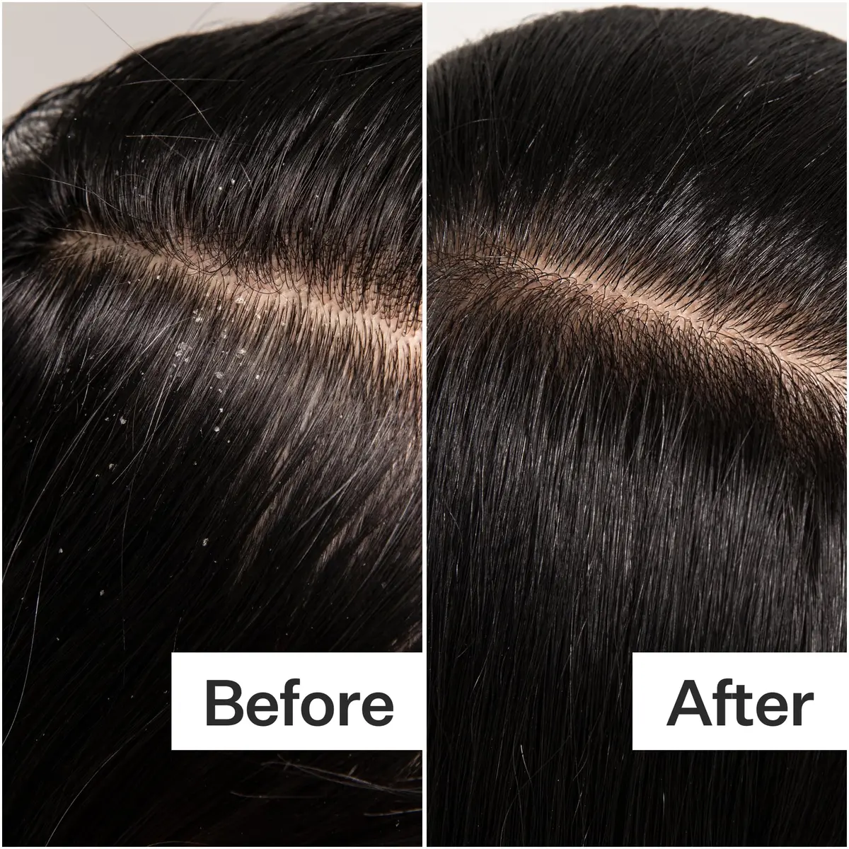 ACT+ ACRE Cold Processed Scalp Detox Oil 3 Fl Oz | Sulfate-Free for Dry & Itchy Scalp, Promotes Thicker Hair - view 6