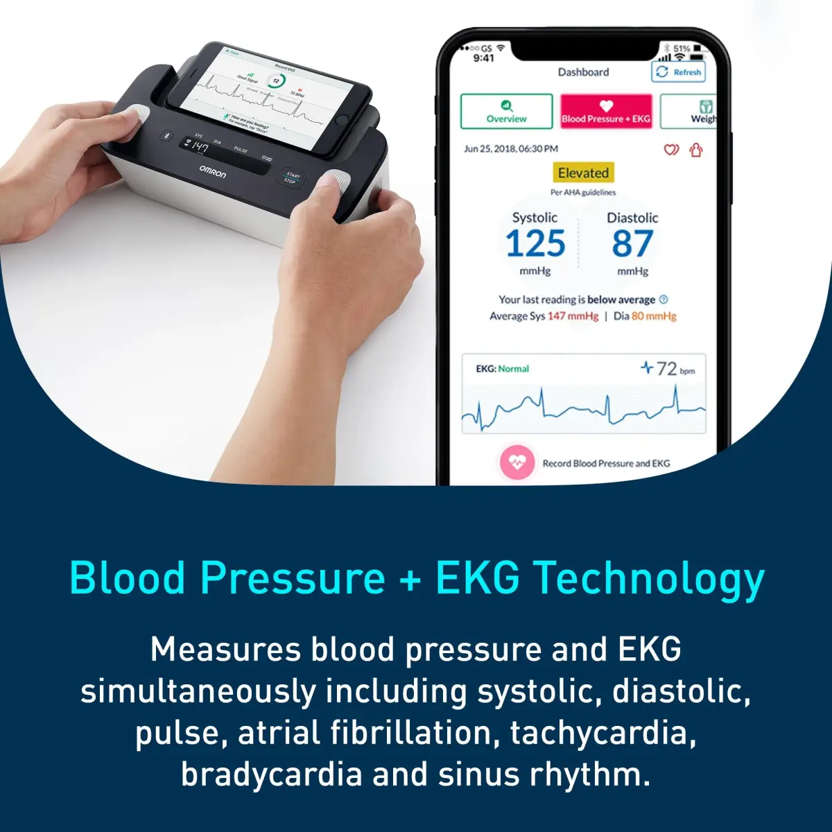 OMRON Complete 2-in-1 Blood Pressure Monitor + EKG BP7900 Black | Advanced Accuracy & Bluetooth Sync - view 3