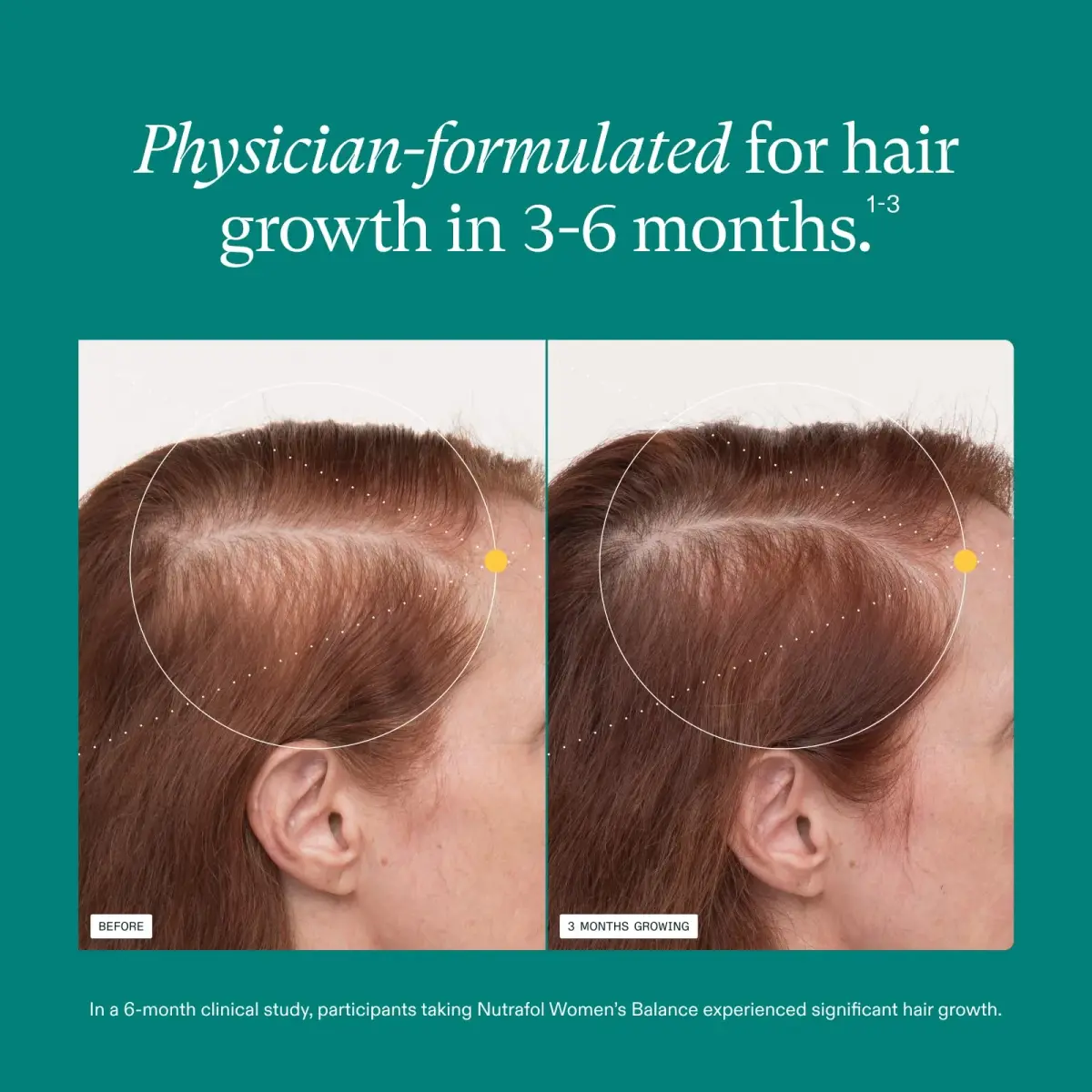 Nutrafol Women's Balance Hair Growth Supplements for Ages 45+, Clinically Tested for Thicker Hair & Scalp Coverage, 1 Month Supply - view 4