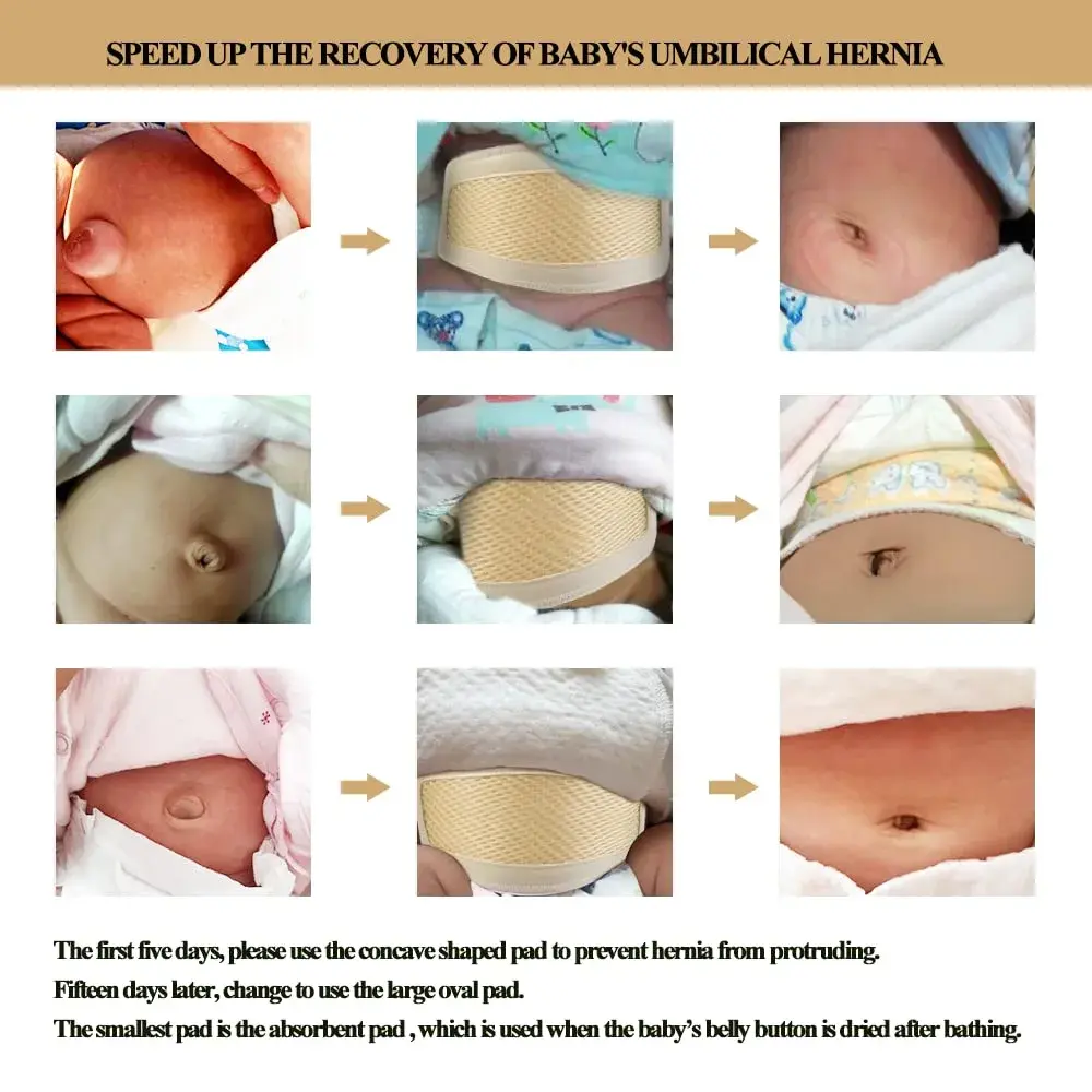 BOJEE Umbilical Hernia Belt for Infants & Kids | 48 cm (19 inch) Beige - view 7