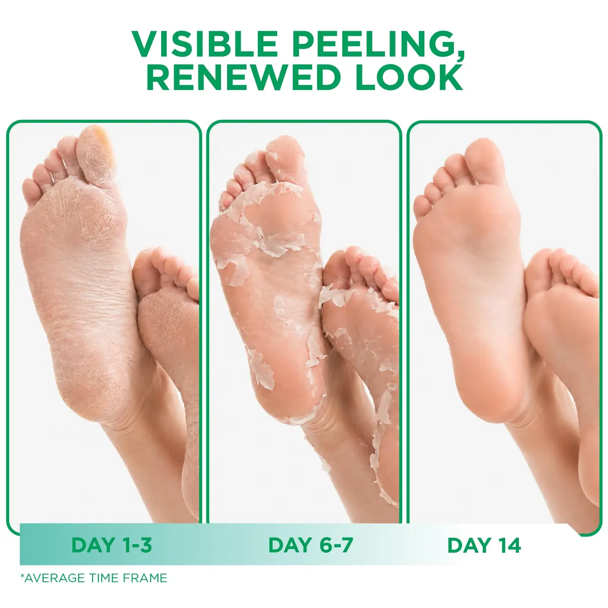 DERMORA Foot Peel Mask, Exfoliating Foot Peeling Mask, 2 Pairs, Tea Tree | Gentle Exfoliation for Dry Feet - view 3