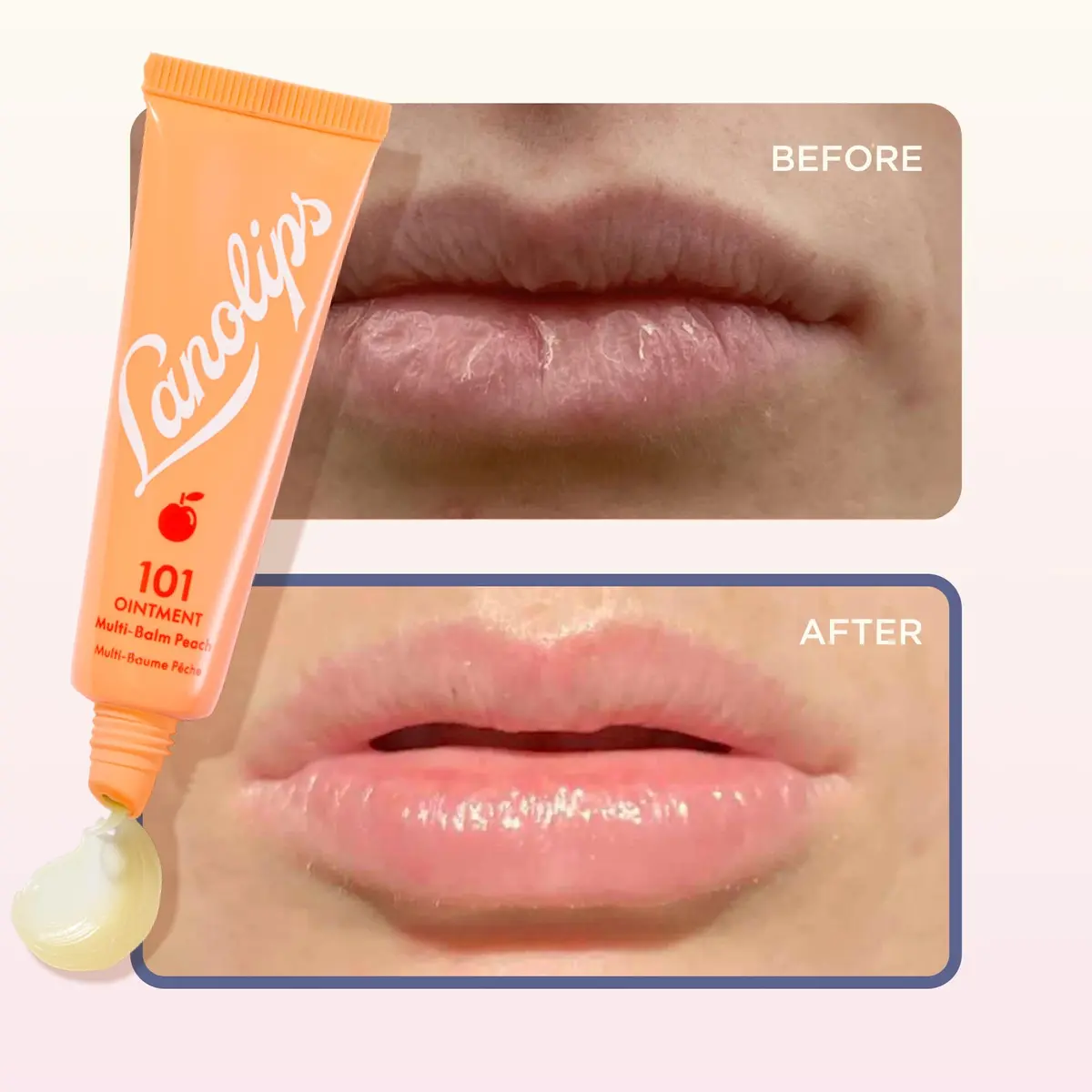 Lanolips Lanolin 101 Multipurpose Ointment Peach | Natural Moisturizer for Dry Lips & Skin (70-120 chars) - view 5