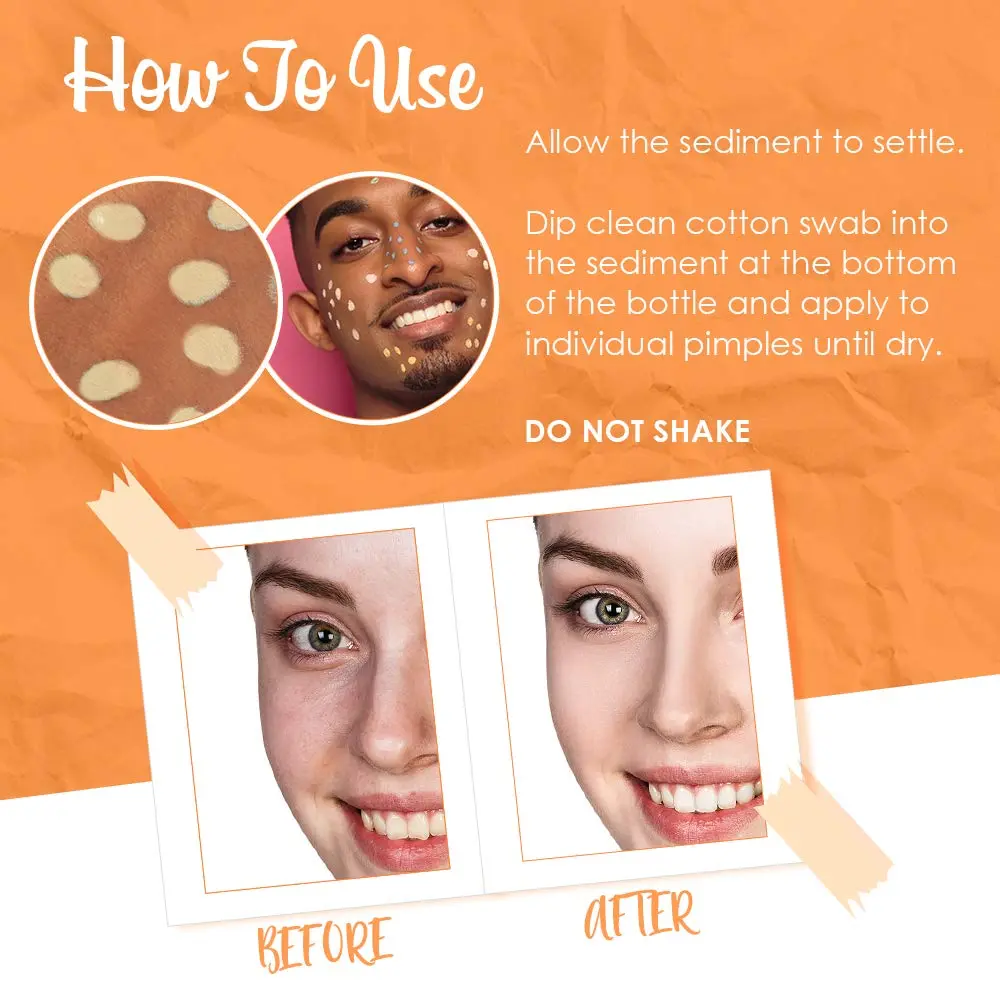 Bye Bye Blemish Vitamin C Lotion 30ml | Brightening & Drying Blemishes Support - view 4
