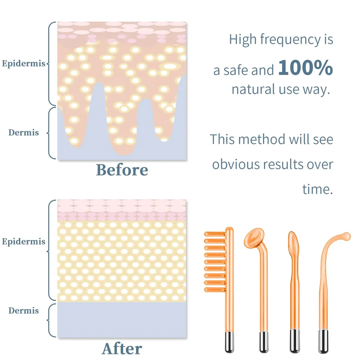 TUMAKOU High Frequency Facial Machine 14PCS | Portable Handheld Skin Therapy Device - view 3