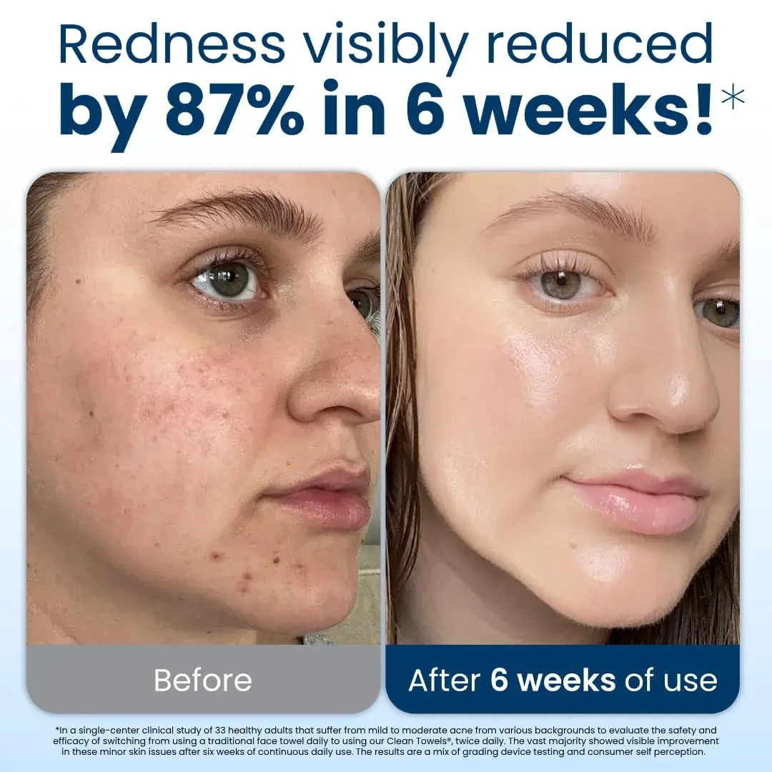 Clean Skin Club Clean Towels XL® Disposable Face Towels 300 Ct (6 Packs of 50 Ct) | USDA Biobased & Eczema Association Accepted - view 3