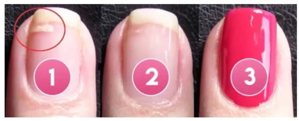 succeedtop Gel Nail Treatment 5ml | Instant Crack Repair & Strengthener - view 5