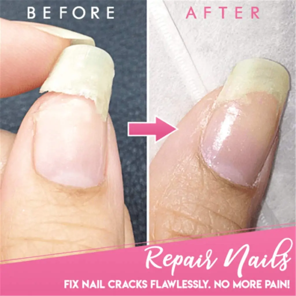 succeedtop Gel Nail Treatment 5ml | Instant Crack Repair & Strengthener - view 4