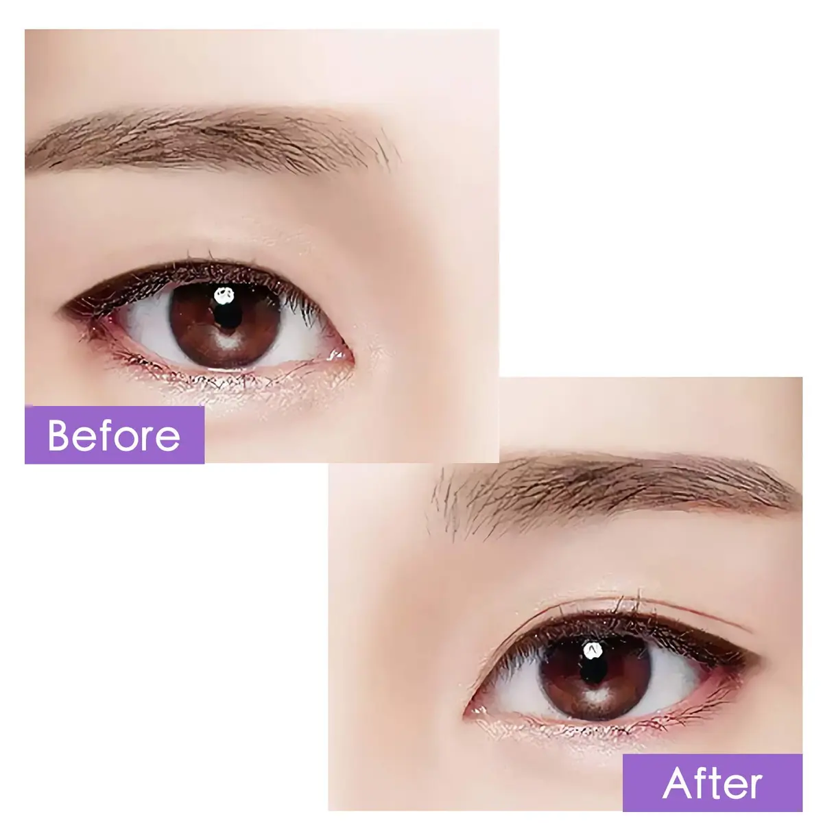 ZMBeauty Eyelid Tapes Stickers 800 pcs (400 Pairs) | Invisible Double Eyelid Tape for Hooded, Uneven, Mono-eye - view 4