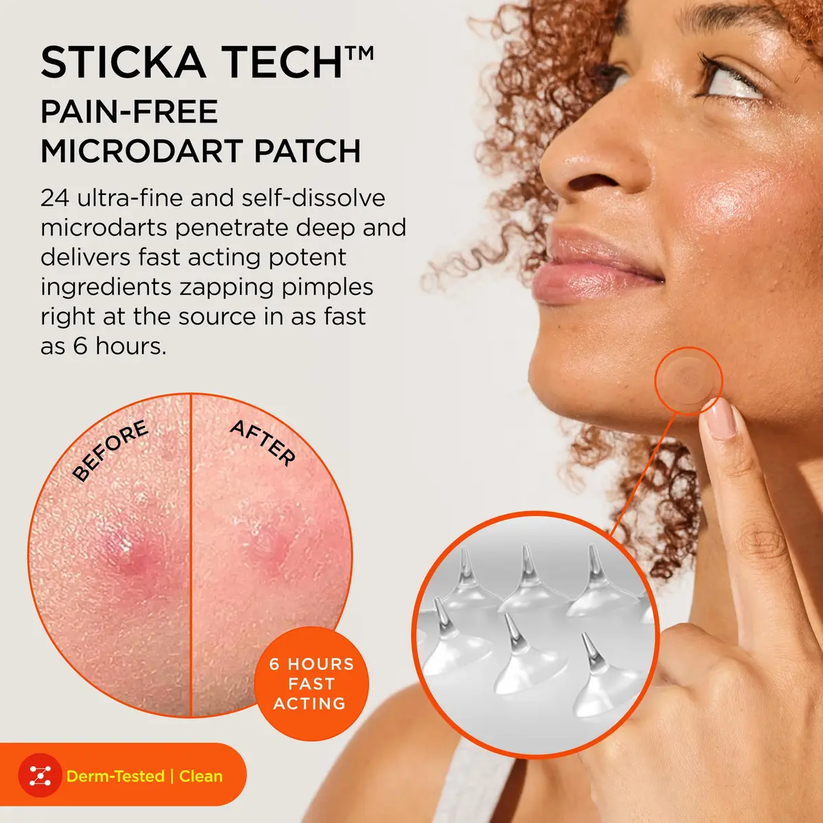 ZitSticka Killa Kit Microdart Pimple Patch for Face, 4 Count | Fast-Acting, Deep Zits Targeted - view 2