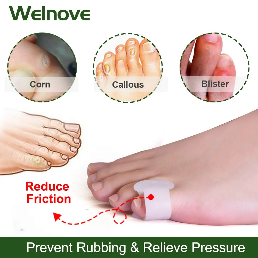 Welnove Gel Toe Separator, Pinky Toe Spacers, Little Toe Cushions | Prevents Rubbing & Relieves Pressure - view 3