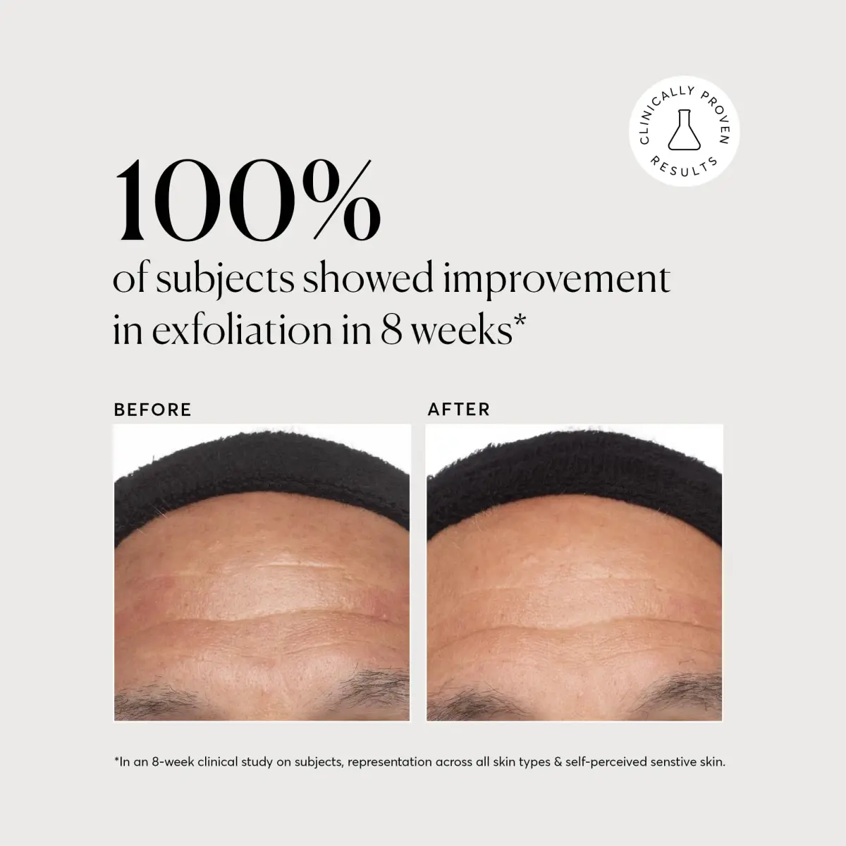 Naturium Azelaic Topical Acid 10% Serum 30ml (1 oz) | Reduces Redness & Improves Skin Tone - view 4