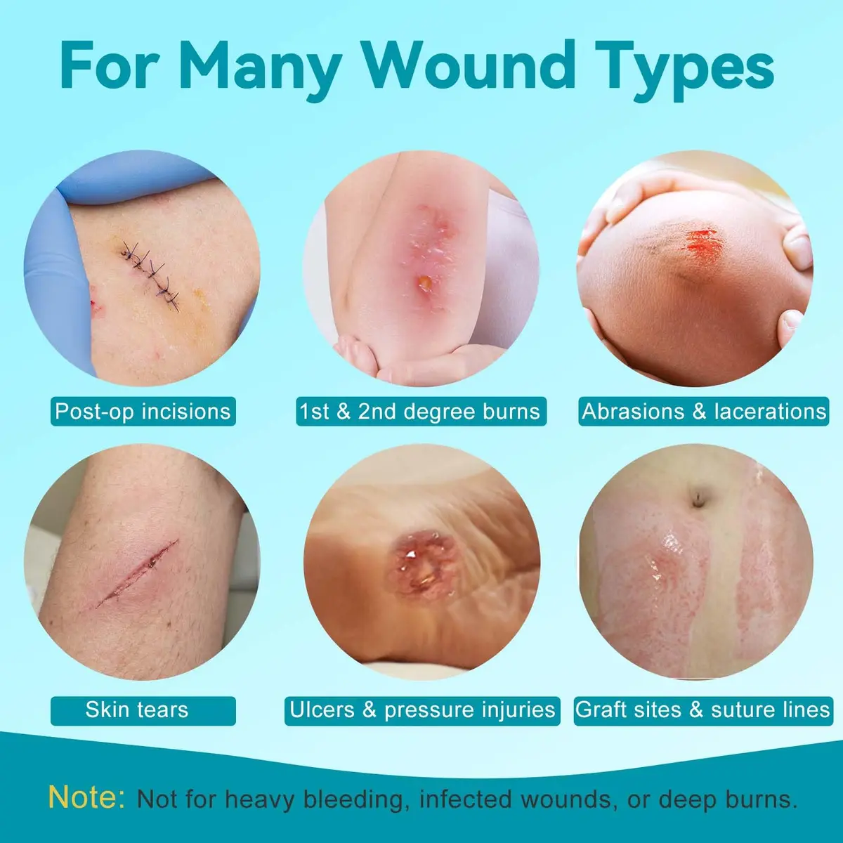 Dimora Silicone Wound Contact Layer 10 pcs | Non-adhering, Transparent, 7.5cm x 10cm - view 5