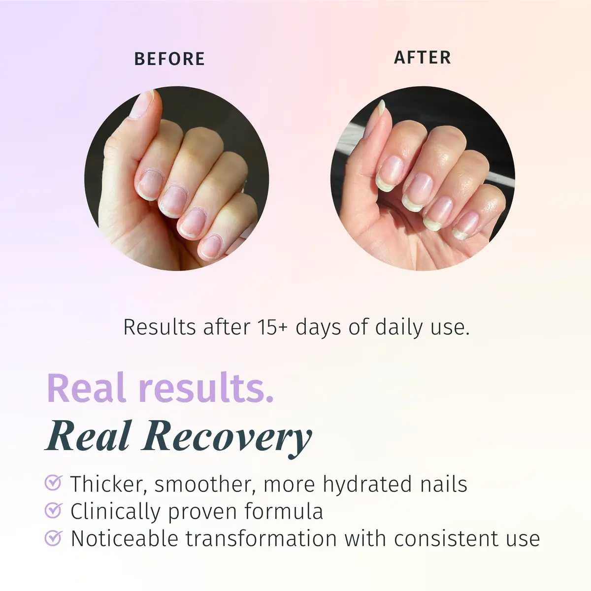 Duri Rejuvacote 2 Balanced Repair Nail Growth Base and Top Coat, 0.45 Fl Oz (Pack of 3) | Strengthens & Repairs Fragile Nails - view 2