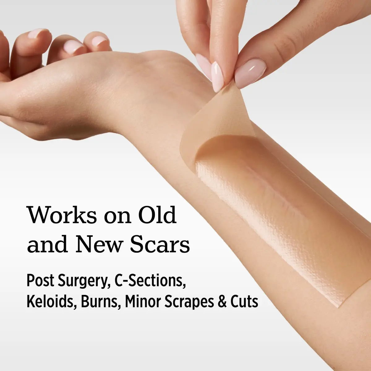 NUVADERMIS Silicone Scar Sheets for Surgical & Old Scars | Hydrating, Comfortable & Dermatologist Tested - view 3