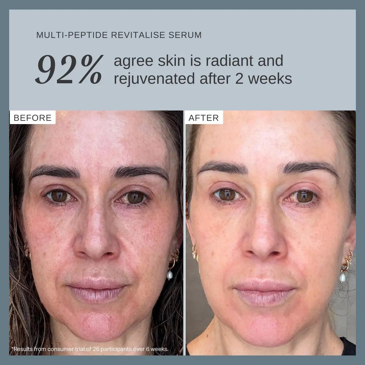 Alpha-H Multi-Peptide Face Serum 30ml | Firms & Plumps Fine Lines, Lightweight & Cruelty-Free - view 4
